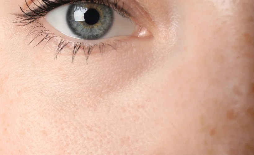 Face skin compare 1